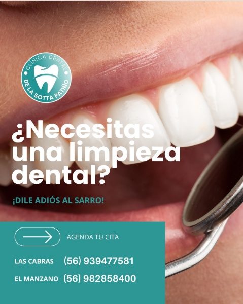 Post: ¿Necesitas una limpieza dental? ¡Dile adiós al sarro!